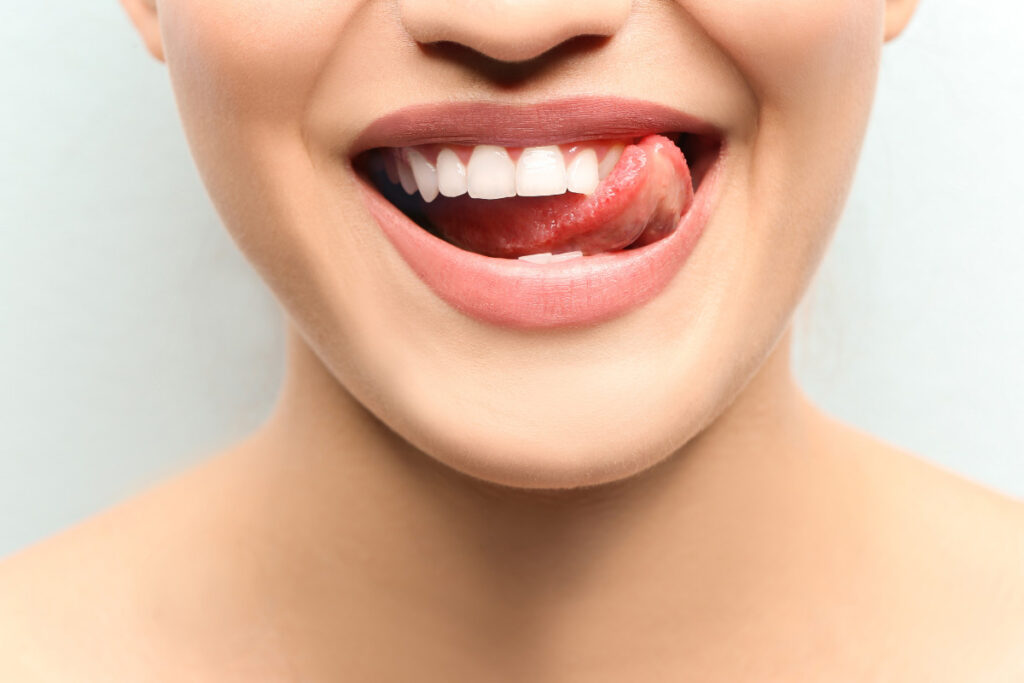 Tratamiento de medicina estética "Sonrisa Gingival" - Clínica de Belleza y Bienestar en la Eliana